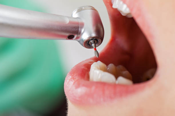 Best Dentist for Dental Trauma  in Hurricane, WV